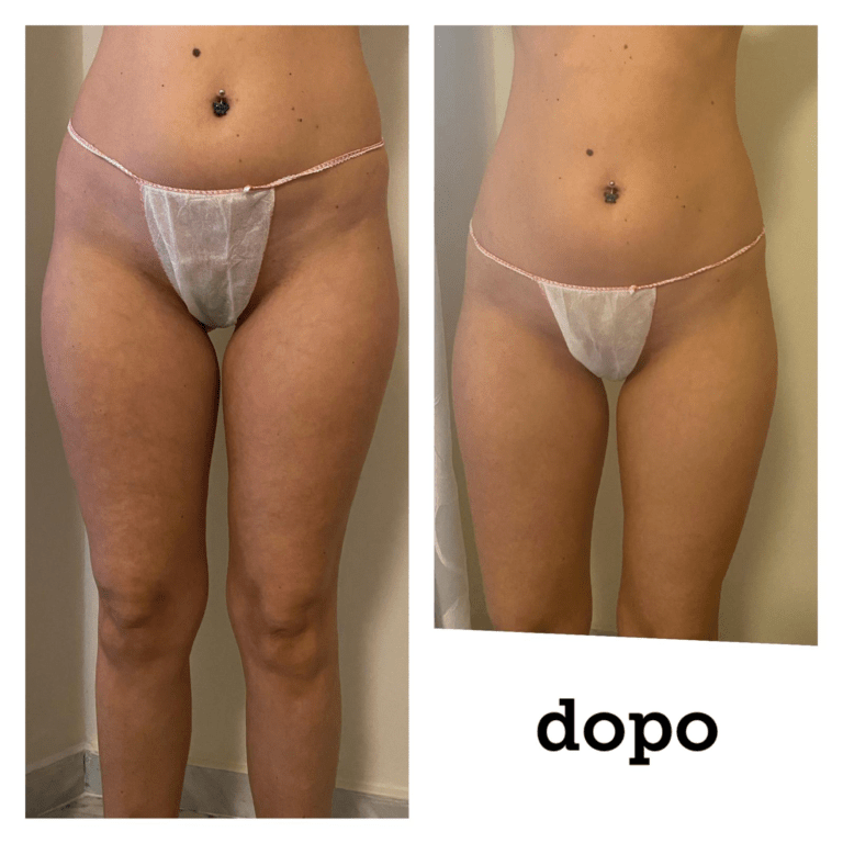 Prima-Dopo-000003